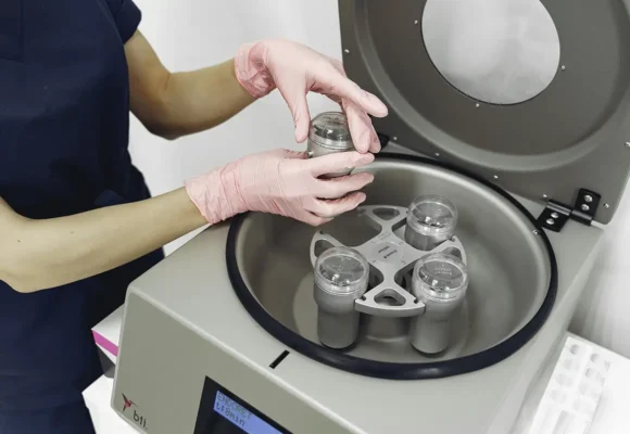 In-vitrofertilisatie (IVF) bij MC Kinderwens